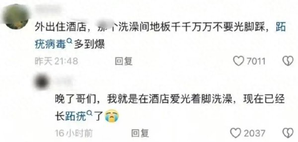 在货仓赤脚洗浴后感染HPV? 医师蹙迫提示